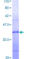 ANXA1 / Annexin A1 Protein - 12.5% SDS-PAGE Stained with Coomassie Blue.