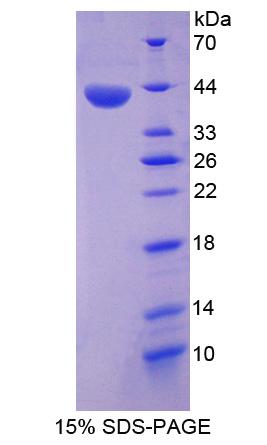 ANXA10 / Annexin A10 Protein - Recombinant Annexin A10 By SDS-PAGE