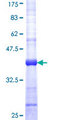 ANXA11 / Annexin XI Protein - 12.5% SDS-PAGE Stained with Coomassie Blue.