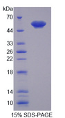 ANXA11 / Annexin XI Protein - Recombinant Annexin A11 By SDS-PAGE