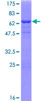 ANXA13 / Annexin XIII Protein - 12.5% SDS-PAGE of human ANXA13 stained with Coomassie Blue
