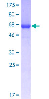 ANXA2 / Annexin A2 Protein - 12.5% SDS-PAGE of human ANXA2 stained with Coomassie Blue
