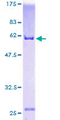 ANXA2 / Annexin A2 Protein - 12.5% SDS-PAGE of human ANXA2 stained with Coomassie Blue