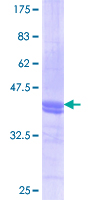 ANXA2 / Annexin A2 Protein - 12.5% SDS-PAGE Stained with Coomassie Blue.