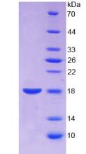 ANXA2 / Annexin A2 Protein - Recombinant Annexin A2 By SDS-PAGE