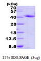 ANXA2 / Annexin A2 Protein