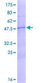 ANXA2R / AX2R Protein - 12.5% SDS-PAGE of human ANXA2R stained with Coomassie Blue