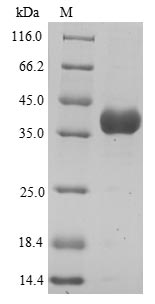 ANXA3 / Annexin A3 Protein - (Tris-Glycine gel) Discontinuous SDS-PAGE (reduced) with 5% enrichment gel and 15% separation gel.