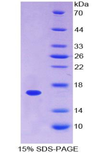 ANXA3 / Annexin A3 Protein - Recombinant Annexin A3 By SDS-PAGE