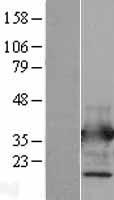 ANXA5 / Annexin V Protein - Western validation with an anti-DDK antibody * L: Control HEK293 lysate R: Over-expression lysate