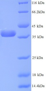 ANXA5 / Annexin V Protein