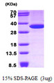 ANXA5 / Annexin V Protein