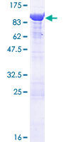 ANXA6/Annexin A6/Annexin VI Protein - 12.5% SDS-PAGE of human ANXA6 stained with Coomassie Blue