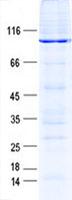 ANXA6/Annexin A6/Annexin VI Protein