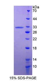ANXA6/Annexin A6/Annexin VI Protein - Recombinant  Annexin A6 By SDS-PAGE
