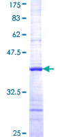 ANXA7 / Annexin VII / SNX Protein - 12.5% SDS-PAGE Stained with Coomassie Blue.