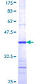 ANXA7 / Annexin VII / SNX Protein - 12.5% SDS-PAGE Stained with Coomassie Blue.