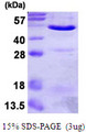 ANXA7 / Annexin VII / SNX Protein