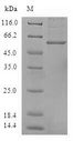 ANXA8L1 Protein - (Tris-Glycine gel) Discontinuous SDS-PAGE (reduced) with 5% enrichment gel and 15% separation gel.