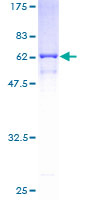 ANXA9 Protein - 12.5% SDS-PAGE of human ANXA9 stained with Coomassie Blue