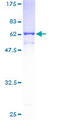 ANXA9 Protein - 12.5% SDS-PAGE of human ANXA9 stained with Coomassie Blue