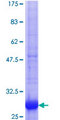 ANXA9 Protein - 12.5% SDS-PAGE Stained with Coomassie Blue