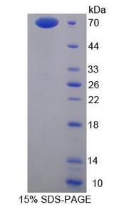 ANXA9 Protein - Recombinant  Annexin A9 By SDS-PAGE