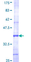 AOAH / Acyloxyacyl Hydrolase Protein - 12.5% SDS-PAGE Stained with Coomassie Blue.
