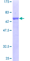 AOC1 Protein - 12.5% SDS-PAGE of human ABP1 stained with Coomassie Blue
