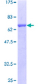AOC1 Protein - 12.5% SDS-PAGE of human ABP1 stained with Coomassie Blue