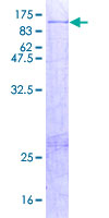 AOC2 / SSAO Protein - 12.5% SDS-PAGE of human AOC2 stained with Coomassie Blue