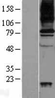 AOC3 / VAP-1 Protein - Western validation with an anti-DDK antibody * L: Control HEK293 lysate R: Over-expression lysate
