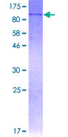 AOC3 / VAP-1 Protein - 12.5% SDS-PAGE of human AOC3 stained with Coomassie Blue