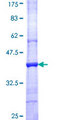 AOC3 / VAP-1 Protein - 12.5% SDS-PAGE Stained with Coomassie Blue.