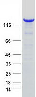 AOX1 / Aldehyde Oxidase Protein - Purified recombinant protein AOX1 was analyzed by SDS-PAGE gel and Coomassie Blue Staining