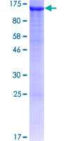 AP1B1 / BAM22 Protein - 12.5% SDS-PAGE of human AP1B1 stained with Coomassie Blue