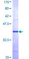 AP1G2 Protein - 12.5% SDS-PAGE Stained with Coomassie Blue.