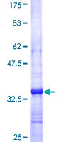 AP1M1 Protein - 12.5% SDS-PAGE Stained with Coomassie Blue.