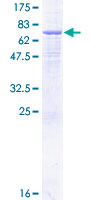AP1M2 Protein - 12.5% SDS-PAGE of human AP1M2 stained with Coomassie Blue