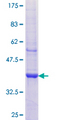 AP1M2 Protein - 12.5% SDS-PAGE Stained with Coomassie Blue.