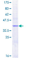 AP1S1 Protein - 12.5% SDS-PAGE of human AP1S1 stained with Coomassie Blue