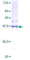 AP1S2 Protein - 12.5% SDS-PAGE of human AP1S2 stained with Coomassie Blue