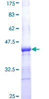 AP2A1 / AP2-Alpha Protein - 12.5% SDS-PAGE Stained with Coomassie Blue.
