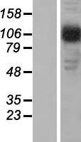 AP2B1 Protein - Western validation with an anti-DDK antibody * L: Control HEK293 lysate R: Over-expression lysate
