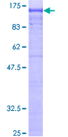 AP2B1 Protein - 12.5% SDS-PAGE of human AP2B1 stained with Coomassie Blue