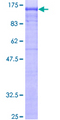 AP2B1 Protein - 12.5% SDS-PAGE of human AP2B1 stained with Coomassie Blue