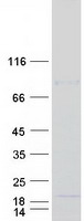 AP2S1 Protein - Purified recombinant protein AP2S1 was analyzed by SDS-PAGE gel and Coomassie Blue Staining