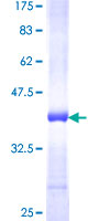 AP3B1 Protein - 12.5% SDS-PAGE Stained with Coomassie Blue.
