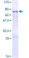 AP3M1 Protein - 12.5% SDS-PAGE of human AP3M1 stained with Coomassie Blue