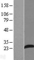 AP3S1 Protein - Western validation with an anti-DDK antibody * L: Control HEK293 lysate R: Over-expression lysate